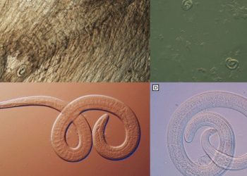 Family members infected with brainworms after consuming undercooked bear meat