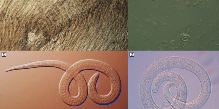 Family members infected with brainworms after consuming undercooked bear meat