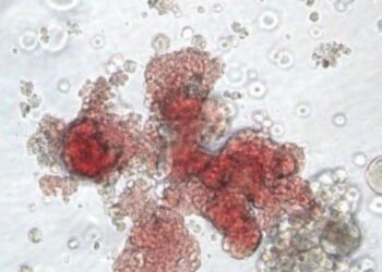 Report: Britain Covered Up Tainted Blood Scandal That Killed Thousands