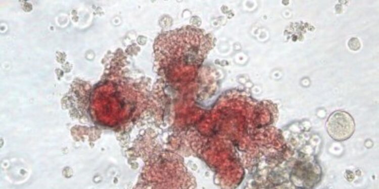 Report: Britain Covered Up Tainted Blood Scandal That Killed Thousands